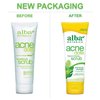 Alba Botanica Acnedote Face & Body Scrub, Maximum Strength 8 oz ( Pack of 3)