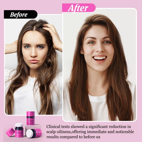 Dry Shampoo Powder, Volumizing, Mattifying Root Fuller, Refreshing, Travel Size Dry Shampoo, Hair Powder for Women and Men, No White Cast, Non Aerosol, Hair Care, Suitable for All Hair Colors