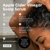 dpHUE Apple Cider Vinegar Scalp Scrub with Pink Himalayan Sea Salt, 9 oz - Natural Exfoliating Scrub & Dry Scalp Treatment - Aloe Vera & Avocado Oil - Gluten Free, Vegan