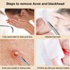 2-in-1 Pimple Extractor Removal Tools - Professional Blackhead Remover Popper Tools - Acne Comedone Tool for Face Nose [2 Pack]