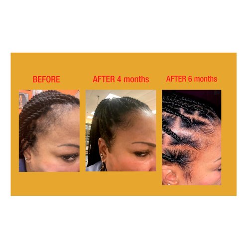 Gold Banner Beauty LOC'D 4 LYFE Leave-In Conditioner 8oz – Moisturizing & Shine-Enhancing Formula for Strengthening & Repairing Locs | Vegan, Cruelty-Free & No Residue for Healthy Hair