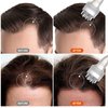NERNJIM Minoxidil Applicator, Scalp Oil Applicator - Transparent easy to Observe, Easy to Clean, Controlled Flow Rate - Ideal for Minoxidiland & Wild Growth Hair Oil