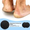 20 Pieces Regular Coarse Replacement Pads for Portable Electric Foot Grinder Foot File Refills Vacuum Adsorption Electric Callus Remover Hard Skin Grind Head for Cracked Heels Dead Skin (Black)