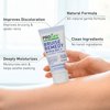 PROcure Remedy Gel with Arnica, Helps Improve the Appearance of Bruises & Spider Veins on the Foot and Ankle, Unscented & Paraben Free with Soft Touch Applicator, 2 Fl Oz