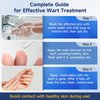 Ragkun Fast-Acting Skin Tag Remover Wart Remover with Salicylic Acid, Wart Removal for Women Men, Wart Freeze Off for Plantar Wart,Flat,Common, Corn,H Wart, Callus 30ML