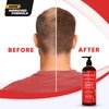 Anti-Hair Loss Shampoo With Biotin, for Men & Women - Sulfate-Free, Natural DHT Blocking Formula for Hair Growth, Thinning Hair Prevention, 16 Oz