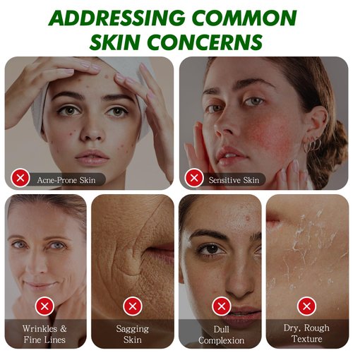 HUYEHF Snail Repair Cream, Snail Mucin 92% Repair Cream, Daily Face Gel Moisturizer Snail Cream for Dry Skin Acne-prone Sensitive Skin-100g