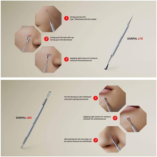Suvorna Skinpal Pimple Popper Tool Kit | Milia Remover | Lancets for Facial Extraction | Whitehead Extractor Tool | Comedone Extractor | Blackhead Remover Tool | Acne Needle Tool & Cyst Removal Tool.