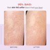 First Aid Beauty - KP Bump Eraser Body Scrub with 10% AHA, Keratosis Pilaris Exfoliater with Glycolic and Lactic acids, Helps Reduce Chicken Skin Bumps, Safe for Sensitive Skin, Strawberry Scent, 8 oz