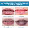 2PC Lip Balm Remove Dark Pigment Whitening Moisturizing Lip Hyaluronic Acid Exfoliating Dead Skin Lightening Lip Care (Orange)
