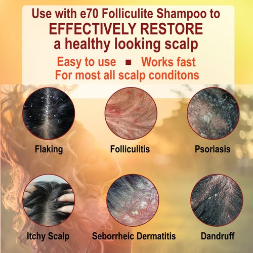 Shampoo & Conditioner Set, Salicylic Shampoo for Folliculitis, Dandruff, Oily Scalp. Parabens-Free | Treat Folliculitis with Herbal Hair Conditioner - Soothe Scalp, Repair Hair, Gentle & colour-safe!