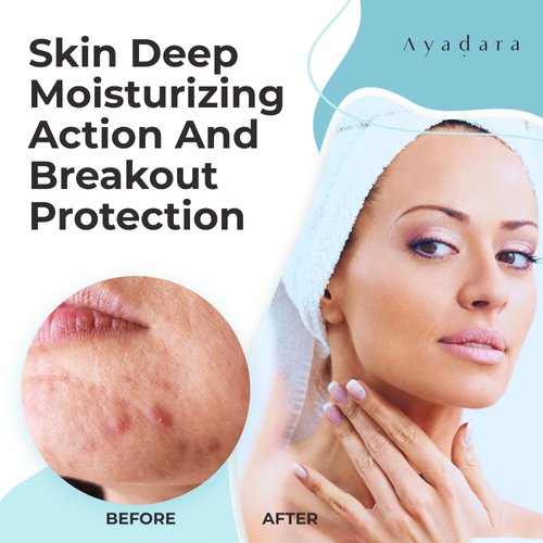 AYADARA Breakout Warrior Acne Cream, 90-Day Supply, Acne Moisturizer for Face and Body, Salicylic Acid Acne Treatment, Acne Facial Moisturizer for Oily, Blackhead, Whitehead, For All Types of Skin