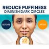 Under Eye Patches for Dark Circles and Puffy Eyes (30 Pairs), Marine Collagen Eye Mask for Puffiness with Vitamin C, Hyaluronic Acid, and Pearl Extract, Eye Gel Pads for Dark Circles and Puffiness