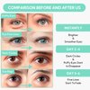 8X Hyaluronic Acid Under Eye Patches(30 Pairs) -Cooling Eye Masks for Deep Moisturizing, with Ectoin Niacinamide Hydra-Gel Collagen, Puffy Eyes Treatment, Fine Lines & Wrinkles Reduce