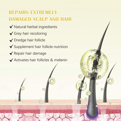 5% Minoxidil for Men and Women Hair Growth Serum Oil, 2.02 oz Hair Regrowth Serum with Biotin for Scalp Hair Loss, Natural Hair Regrowth Treatment for Stronger Thicker Fuller Healthier Hair