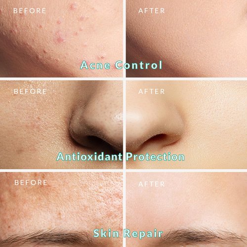 PureNaturis Organic Dead Sea Clay Mud Mask - Deep Pore Cleansing, Antioxidant & Mineral-Rich Skincare, Balances Oil, Soothes & Detoxifies, Ideal for All Skin Types, 2.8 oz