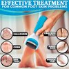 Electric Callus Remover for Feet - Foot Heel Callus Remover Callus File Wet Dry Cracked Feet Callus Removal Pedicure Tool for Feet Care - Electric Foot File Pedicure Foot Spa Callus Shaver for Feet