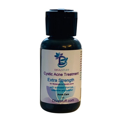 Cystic Acne Spot Treatment Bottle, for Moderate to Severe Acne, Made With Activated Charcoal, Fast Acting Formula Reduces Inflammation and Dries Out the Blemish Quickly, By Diva Stuff