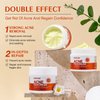 Acne Treatment for Face, Acne Cream Back Acne Treatment Cream for Teens & Adults Anti-acne Pimple Cream Butt Acne Clearing Cream, Acne Spot Treatment