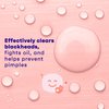 Clean & Clear Essentials Oil-Free Deep Cleaning Face Astringent with 2% Salicylic Acid Acne Medication for All Skin Types, Facial Astringent to Treat & Help Prevent Pimples, 8 fl. oz