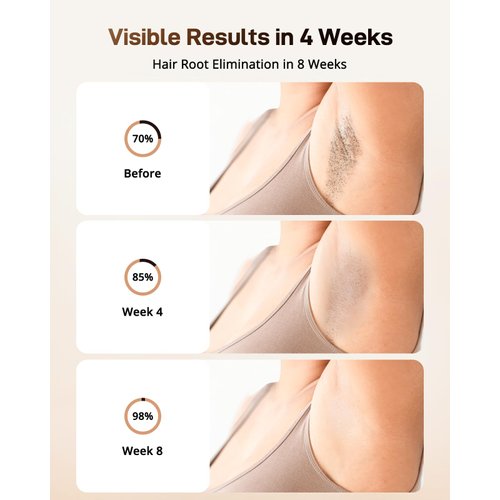 AMOTAOS IPL Laser Hair Removal for Women and Men, Ice-Cooling Laser Hair Removal Device Safe at-Home Epilators for Face Armpits Arms Bikini Line Legs Whole Body