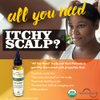 Organic Anti-itch Scalp Treatment, Soothing and Nourishing Treatment for Dry, Flaky Scalps, Anti-Dandruff Scalp Oil Enriched with Tea Tree, Lavender and Rosemary Oil, 2oz