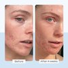 First Aid Beauty Ultra Repair Cream Intense Hydration Moisturizer for Face and Body - 8 oz.