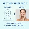 XGZcosmetics Wellvia Gut Cleanse, Purity Shield, Gut and Colon Support, Non-GMO for Women & Men, Black Walnut Hull, Wormwood, Ginger - 2 PCS