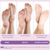 Berlaney Foot Peeling Mask - Pro Callus Remover with Lavender Extract for Rough Cracked Dry Feet - Dead Skin Remove, 3Pairs