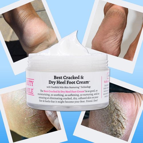 Beauty Of The Nile Best Cracked & Dry Heel Foot Cream™ Remove Dead Callus Moisturize Not Greasy Absorbs Repair Feet Hand Elbow Knee, Urea Mango 5 Oz