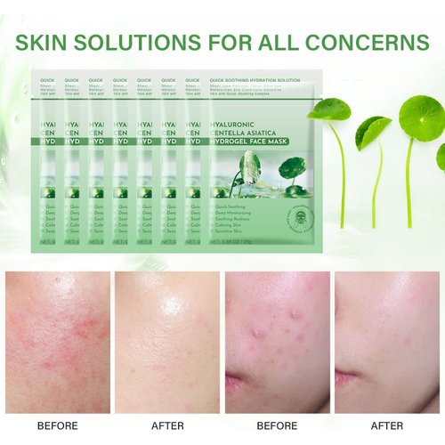 Cica Sheet Mask, Soothing Mask with Aloe,Centella Asiatica,Hyaluronic Acid,Hydrating Facial Sheet Mask for Sensitive Skin,Refreshing,Moisturizing,Deep Repairing,Spa Face Masks Skincare Gifts 10 pack