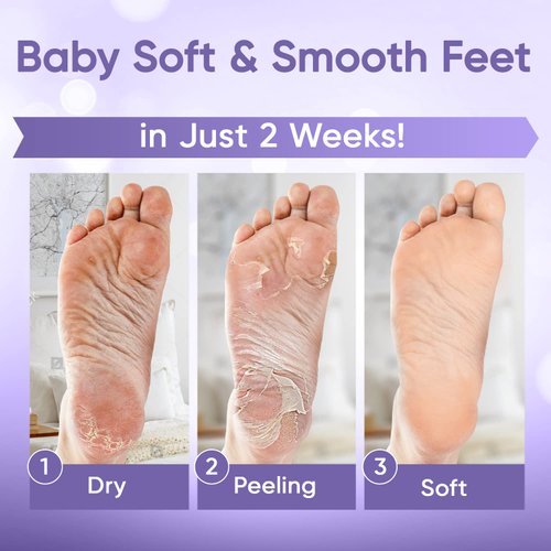 Foot Peeling Mask | Skin Care Pedicure Foot spa - Foot Mask & Foot Callus Remover with Aloe Vera Extract for Baby Soft Skin | Woman & Man | Remove Dead Skin, Cracked Feet & Callus | Lavender (2 Pairs)