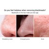 Lambena Puntos Negros, Mascarilla Lambena Para Puntos Negros, Crema Para Puntos Negros Lambena, Mascarilla Para Puntos Negros Nariz Lambena, Black Heads Remover Peel Off Face Mask Nose Strips (1PCS)
