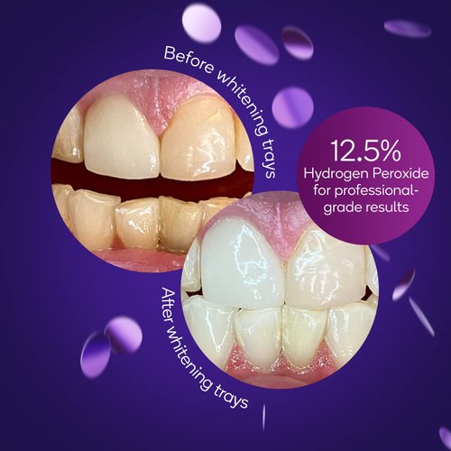 BURST Teeth Whitening Kit - Sensitive Teeth Friendly - 7 Treatments with 12.5% Hydrogen Peroxide - Results in 15 Min. + Up to 6 Shades Whiter in 1 Week - Teeth Whitener with Prefilled Gel Trays