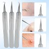 YGQQOY Blackhead Remover Tool, 5Pcs Acne Remover comedone Extractor, Professional Stainless Skin Zit Acne Blemish Whitehead Popping Removing Surgical Tweezers Extraction Tools for Nose Eye Face