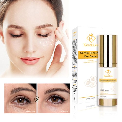 K&K Gentle Renewing Eye Cream with Vitamin C, Aloe Vera, Cucumber & Green Tea – Anti-Wrinkle & Whitening Eye Cream, For All Skin Types, Night Cream, Prone Skin, 30ml