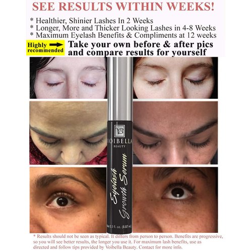 Voibella Eyelash Growth Serum and Eyebrow Appearance Enhancer 8.87ML - Natural Eye Lash Beauty Enhancing and Brow Serum To Boost Healthy Aspect and Show Thick, Longer, Lush and Lavish Lashes