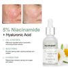 Neutriherbs 4% Niacinamide Serum for Face the Ordinary + HA,Effectively Work to Control Excess Facial Oil, Minimize the Pores and Prevent Breakouts, Best Niacinamide Serum For Oily Skin