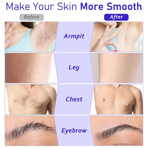 Pinkiou Roll on Wax Kit for Hair Removal Wax Roller Kit Skin Care Wax Up Waxing Warmer with Cartridge Honey Wax Strip at Home Wax Kit for Arm Leg Bikini