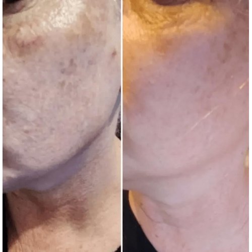 Massage Bead Exfoliating Cleanser Mini