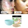 Indian Healing Clay/Natural Bentonite Clay/Detoxifying Wyoming Clay/Deep Pore Cleansing Mask, Face Skin Care, Acne Remover/With Bowl and Spatula
