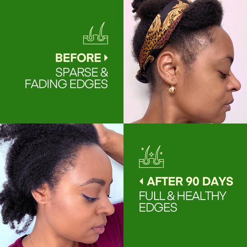 Svvimer Batana Oil for Hair Growth - Dr. Sebi 100％ Pure & Raw Batana Oil from Honduras - Organic & Natural - Promotes Hair Thickness for Men Women 4 Fl Oz (Pack of 1)