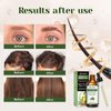 Aeshory Hair Oil - 5 IN 1 Hair Care Oil with Rosemary, Castor, Argan, Vitamin E, and Avocado for Hair Growth and Strengthening - Nourishing and Volumizing 3.38 fl oz