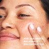 IT Cosmetics Bye Bye Dark Spots 4% Niacinamide Serum - Visibly Reduces Dark Spots & Improves Skin Clarity In 8 Weeks - Facial Serum with 1% Ethyl Vitamin C - For All Skin Types - 1 Fl. Oz