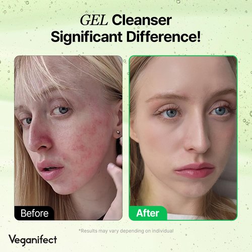 VEGANIFECT Clean and Glow Green Barley Gel Cleanser, Vegan Certified, Hydrating, Improving Skin Texture, 6.93 Fl Oz (New)