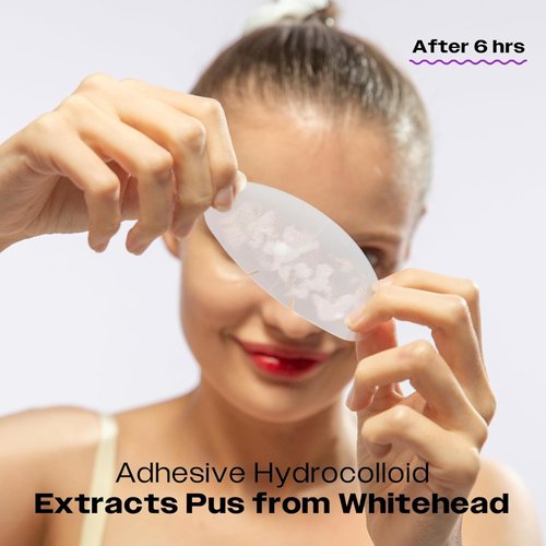 Avarelle ZitOut Nose Patches (16 Strips) | Tea Tree Acne Patches for Nose Zits & Pore Blackhead | Nose Strips for Blackheads with Niacinamide | Blackhead Strips | Hydrocolloid Nose Patches