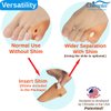 Chiroplax Tailor's Bunion Corrector Pads Bunionette Pain Relief Pinky Little Toe Straightener Separator Cushion Splint Protector Shield Spacer Cover Guard (4 Pads, Shims - Medium)