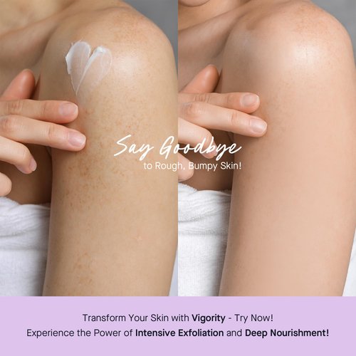 Vigority KP Bump Eraser for Keratosis Pilaris: Body Moisturizer Exfoliating Cream - KP Bump Be Gone Treatment for Bumpy Dry Rough Skin