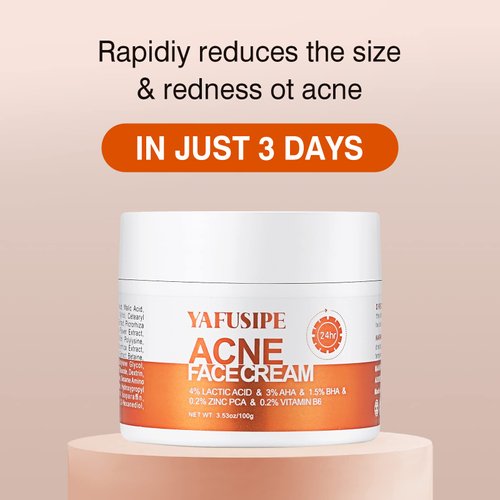 Acne Treatment for Face, Acne Cream Back Acne Treatment Cream for Teens & Adults Anti-acne Pimple Cream Butt Acne Clearing Cream, Acne Spot Treatment