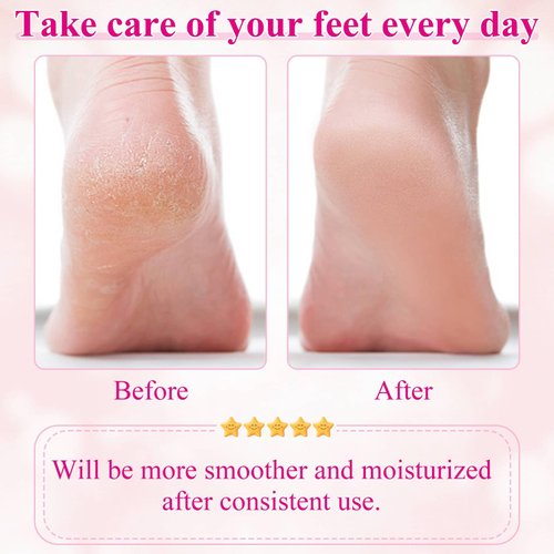 Selizo 4 Pairs Moisturizing Heel Socks for Women, Cracked Heel Socks Gel Heel Socks Callus Remover Socks Open Toe Socks Cracked Foot Toeless Heel Repair Socks for Women Dry Hard Cracked Feet